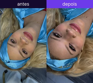 Antes e depois 1
