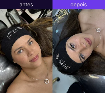 Antes e depois 2