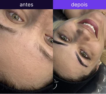 Antes e depois 3