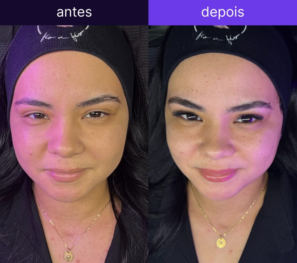 Antes e depois 4